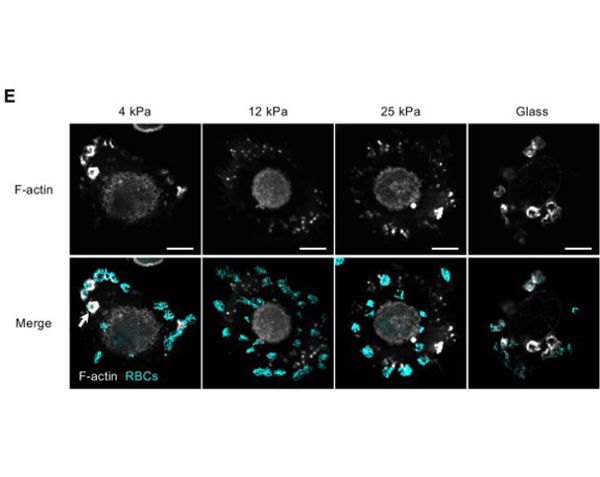 Sheep Blood images of macrophages